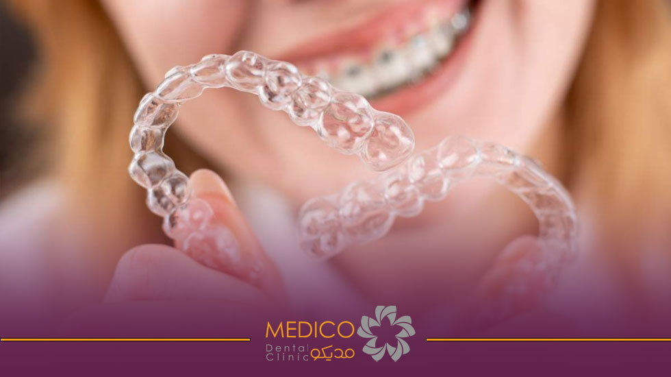 انواع ارتودنسی نامرئی