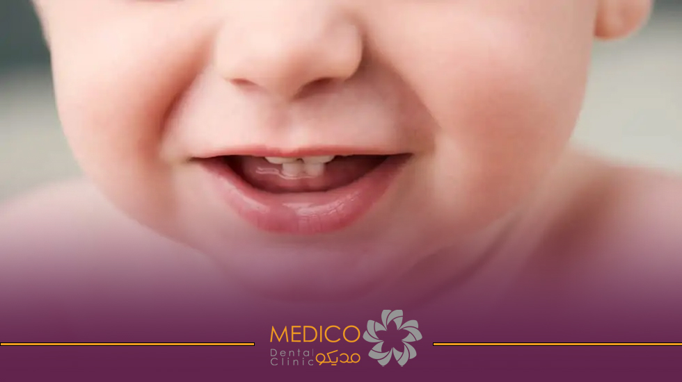 Baby teeth