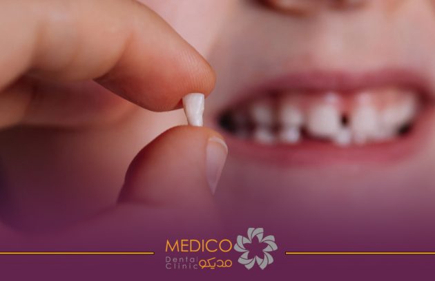 اهمیت دندان های شیری