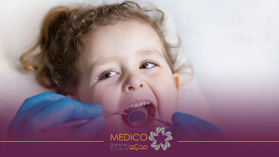 دندان های شیری