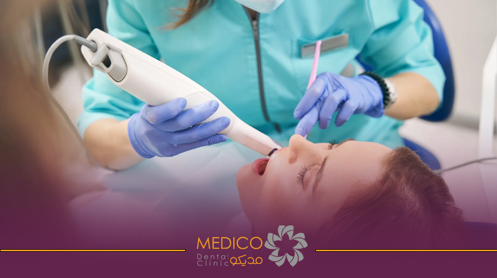 قالب‌گیری دندان