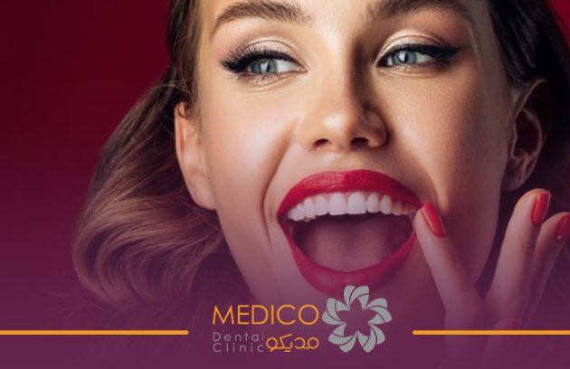 لبخند هالیوودی