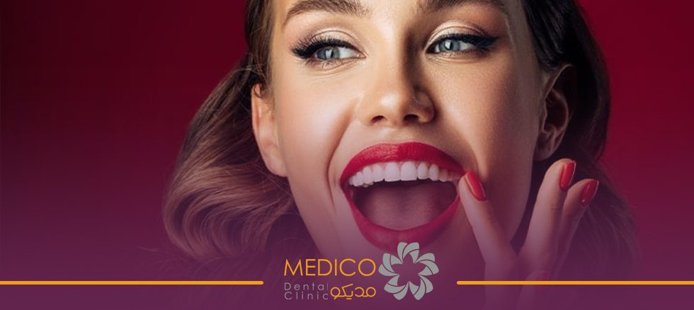 لبخند هالیوودی